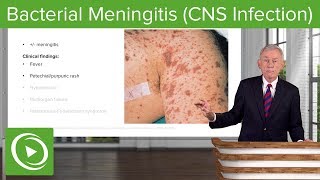 Bacterial Meningitis CNS Infection – Infectious Diseases  Lecturio [upl. by Ahsaei]