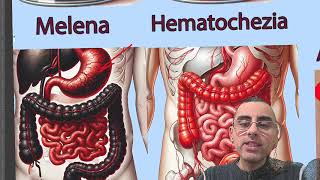 Melena vs Hematochezia Explained symptoms and causes [upl. by Gabi]