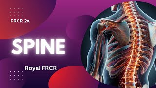 10  Neuroimaging for FRCR [upl. by Eralc]