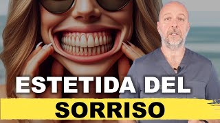 Estetica del sorriso [upl. by Perni]