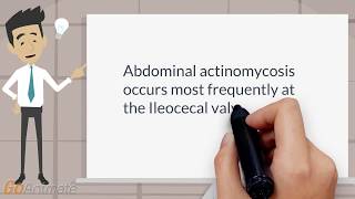 Where does abdominal actinomycosis occur most frequently [upl. by Zalea851]