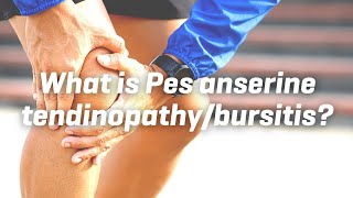 What is Pes anserine tendinopathybursitis [upl. by Haniraz978]