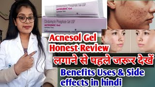 Acnesol gel  Acnesol gel honest review  Ancesol gel benefits uses amp Side effects review in hindi [upl. by Enicar]