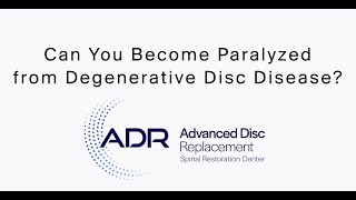 Can You Become Paralyzed from Degenerative Disc Disease [upl. by Oiramat]