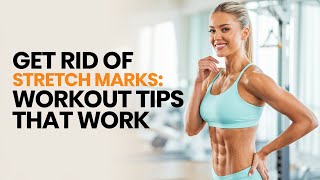 Say Goodbye to Stretch Marks Workout Tips You Need [upl. by Garland]