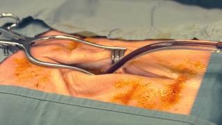 Dr Scalpels Guide to Surgery Dealing with Bleeding Episode 7 [upl. by Euton303]