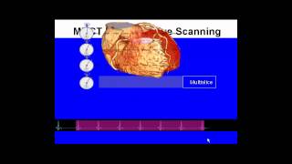 CCTA Training Lecture 1A How Cardiac CT Works [upl. by Anneuq]