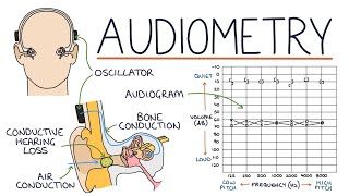 Understanding Audiometry and Audiograms [upl. by Hgielram738]