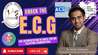 Crack the ECG by Consultant Cardiac Electrophysiologist Dr Sandun Iddagoda [upl. by Janeen]