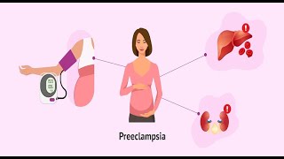 Warning signs of preeclampsia [upl. by Templa499]