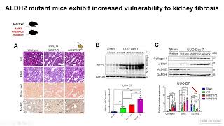 Preserving kidney function with aldehyde dehydrogenase 2 [upl. by Dib625]