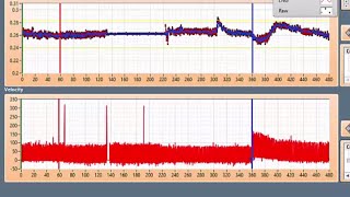 Flow Mediated Dilation  Calculations Software [upl. by Homere]