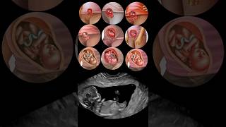 Fetal Development Month by Month😍 [upl. by Orford]