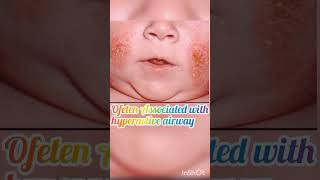 Atopic dermatitis Eczema Alergic diseases childhealth pediatrician parentingtips [upl. by Akers514]