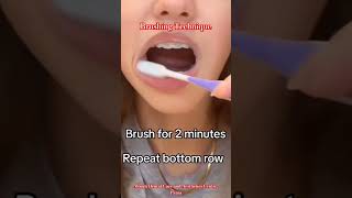 brushing technique orthodontictreatment orthodontist dentalsurgeon bihar patna health hygiene [upl. by Matthews]