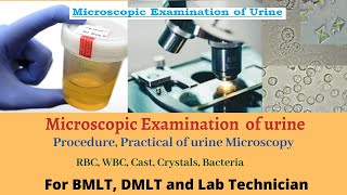 Microscopic examination of urine  urine microscopic examination  urine microscopy  urine test [upl. by Hgielrahc615]