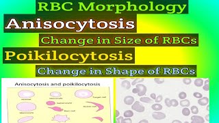 RBC MORPHOLOGY What is Anisocytosis What is Poikilocytosis [upl. by Frans586]