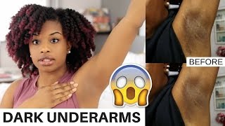 How To Lighten Dark Underarms Naturally and Fast  BEFORE AND AFTER RESULTS  journeytowaistlength [upl. by Witcher]