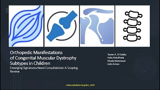 Orthopedic manifestations of congenital muscular dystrophies in children [upl. by Erastes]