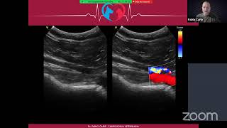 Webinar Ecocardiografia Doppler Veterinaria [upl. by Ardnassela]