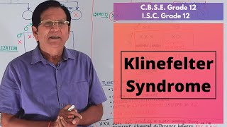 Klinefelter Syndrome  Grade 12 Biology [upl. by Banquer]