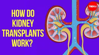 How do kidney transplants work  Alexander H Toledo [upl. by Aicercul]