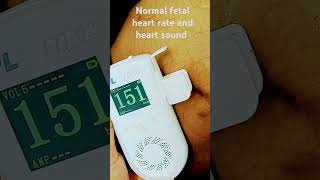 normal fetal heart rate fetal heart sound [upl. by Renruojos777]