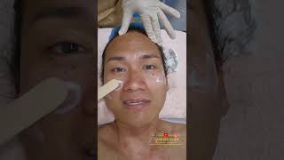 Byebye warts 👋 Watch my latest video to see my amazing treatment results legearsvlog wartsrem [upl. by Aoh]