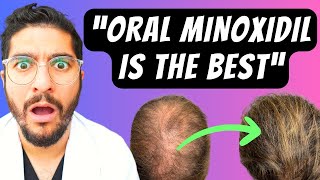 99 Miss This NEW Hair Loss Treatment – Dermatologist Explains [upl. by Asor]