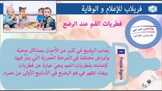 V0030 ما تجهلين عن تقرحات الفم و حلها LES APHTES CHEZ BÉBÉ [upl. by Nahshunn714]