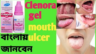 Clenora gelBenefitsSideffectsDosageজিভের ঘাঠোঁটের ঘাদীর্ঘদিন ধরে কোনো ভাবেই ভালো হয় না [upl. by Libbie695]