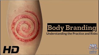 Body Branding Understanding the Practice and Risks [upl. by Nunes]