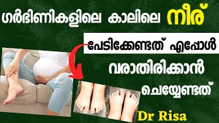 Swelling of Leg During PregnancyPregnancy Healthy Issues [upl. by Filler]