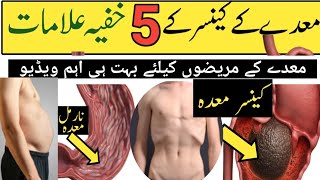 Stomach cancer symptoms and signs  Maiday ki cancer ki alamat in urdu [upl. by Aleahpar483]