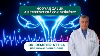 Petefészekrák szűrés  Nőgyógyászati daganatok szűrése  Dr Demeter Attila [upl. by Airad]