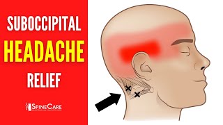 How to Release Tight Suboccipital Muscles  HEADACHE RELIEF in Seconds [upl. by Oehsen]