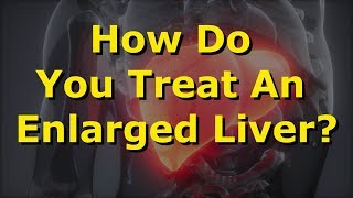 How Do You Treat An Enlarged Liver [upl. by Alvinia]