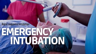 Emergency Intubation RSI in ER step by step approach [upl. by Yddub]