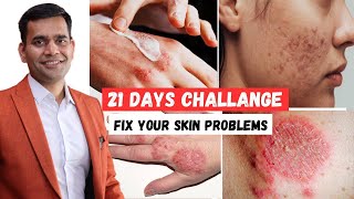 21 Days Challenge  Cure Your All Skin Problems  Dr Vivek Joshi [upl. by Vanya129]