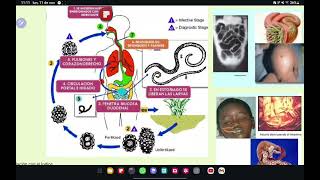 NEMATODOS Enterovius trichuris Ascaris Strongyloides Uncinarias Filariasis Oncocercosisetc💀🧫 [upl. by Gnouv680]