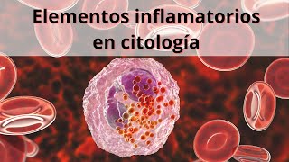 Elementos inflamatorios en citología Glóbulos blancos Leucocitos [upl. by Diley549]