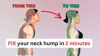 FIX neck hump with 2 minute exercise [upl. by Fassold]