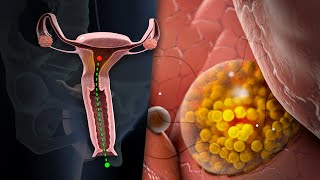 Así es el proceso de la menstruación [upl. by Lorac]