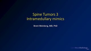 Spine tumors 3 – Intramedullary tumor mimics [upl. by Aiet]