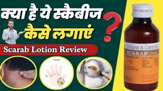 Scarab lotion review  दाद खाजखुजली में उपयोगी  Scarab Kaise lagaye  क्या ये सच में काम करेगा [upl. by Eaton]