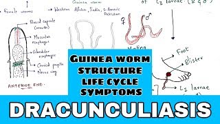 Dracunculiasis  Guinea worm  Structure Life cycle symptoms treatment  Bio science [upl. by Jessi]