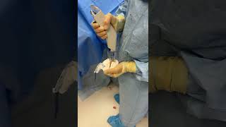 Orthopedic surgery operationtheatre operationtheatretechnician orthopedics shorts [upl. by Kcirded]