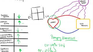 Cardiogenic Shock [upl. by Eico]