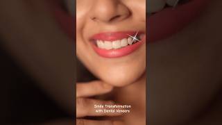 Dental Veneers in Kolkata  Dontia Dental Care Kolkata  Smile Makeover without braces yt shorts [upl. by Hutton]