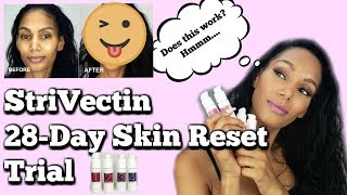 I Did the STRIVECTIN 28DAY SKIN RESET TRIAL  Skincare Review [upl. by Dwain]